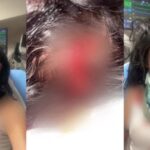 Longview, Texas assault case involving Sammie Lee