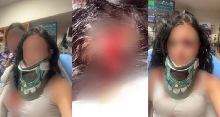Longview, Texas assault case involving Sammie Lee